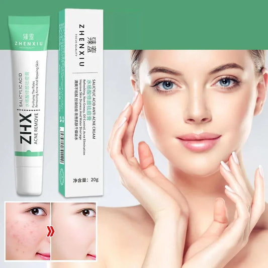 20g Salicylic Acid Shrink Pore Cream for Smooth Skin and Blackhead Removal