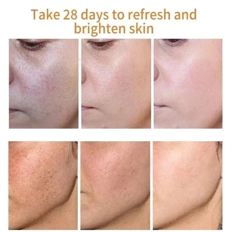 Fades Freckle Dark Spots Face Cream with Niacinamide and Vitamin E