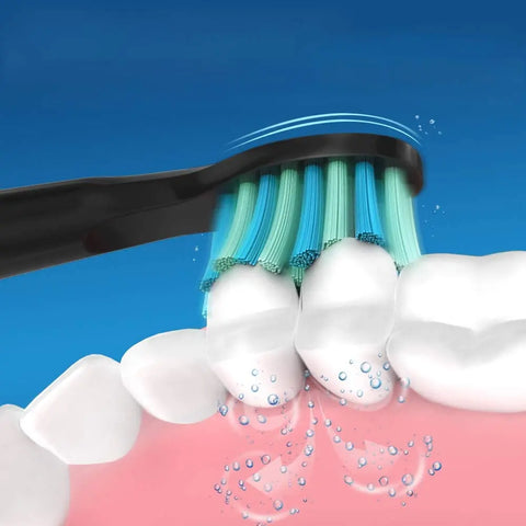 Fairywill Interdental Brush Heads for Sonic Toothbrushes