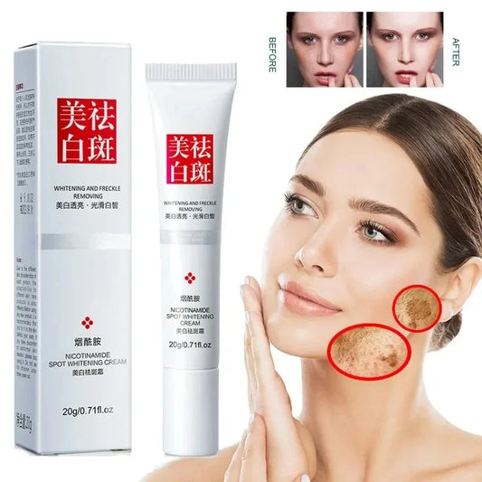 Fades Freckle Dark Spots Face Cream with Niacinamide and Vitamin E