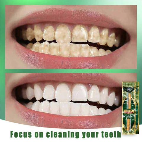 Natural Miswak Toothbrush - Traditional Dental Care